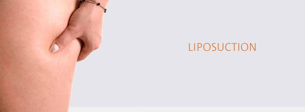 LIPOSUCTION