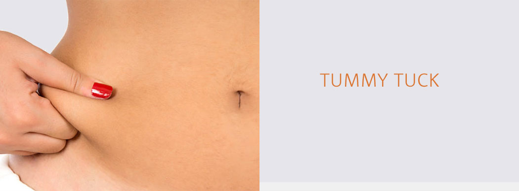 TUMMY TUCK ABDOMINOPLASTY